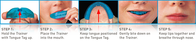 INSTRUCCIONES-T2-MYOBRACE.png